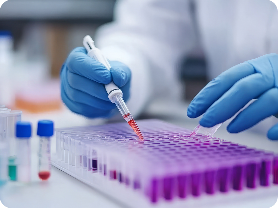 Ricercatore in laboratorio esegue test su campioni con pipetta per i controlli di qualità e sicurezza dei farmaci equivalenti Mylan Viatris.